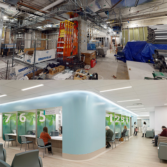 Before and after photo of RAC