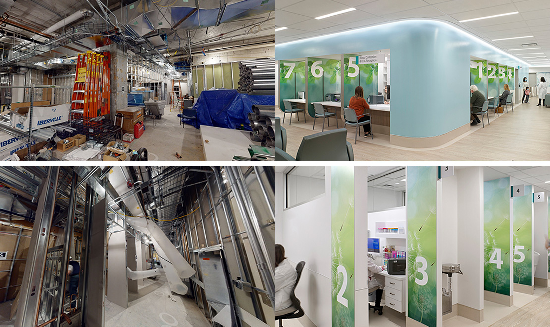 Ideation Post Before and after photos of UHN RAC